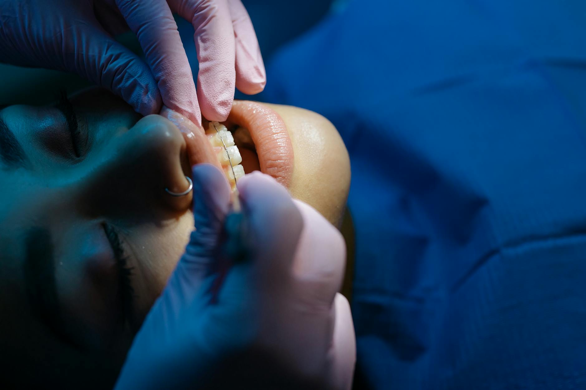 Orthodontist examining patient's teeth during consultation appointment in modern dental office