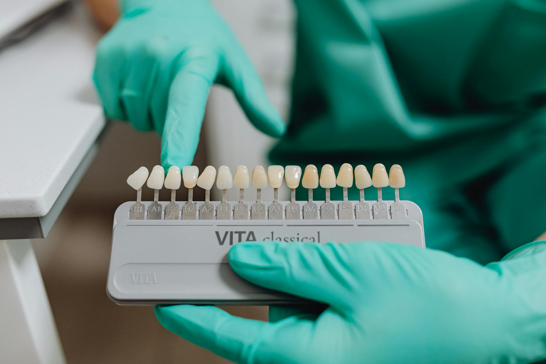 Close-up view of different dental crown materials and types displayed for comparison during consultation