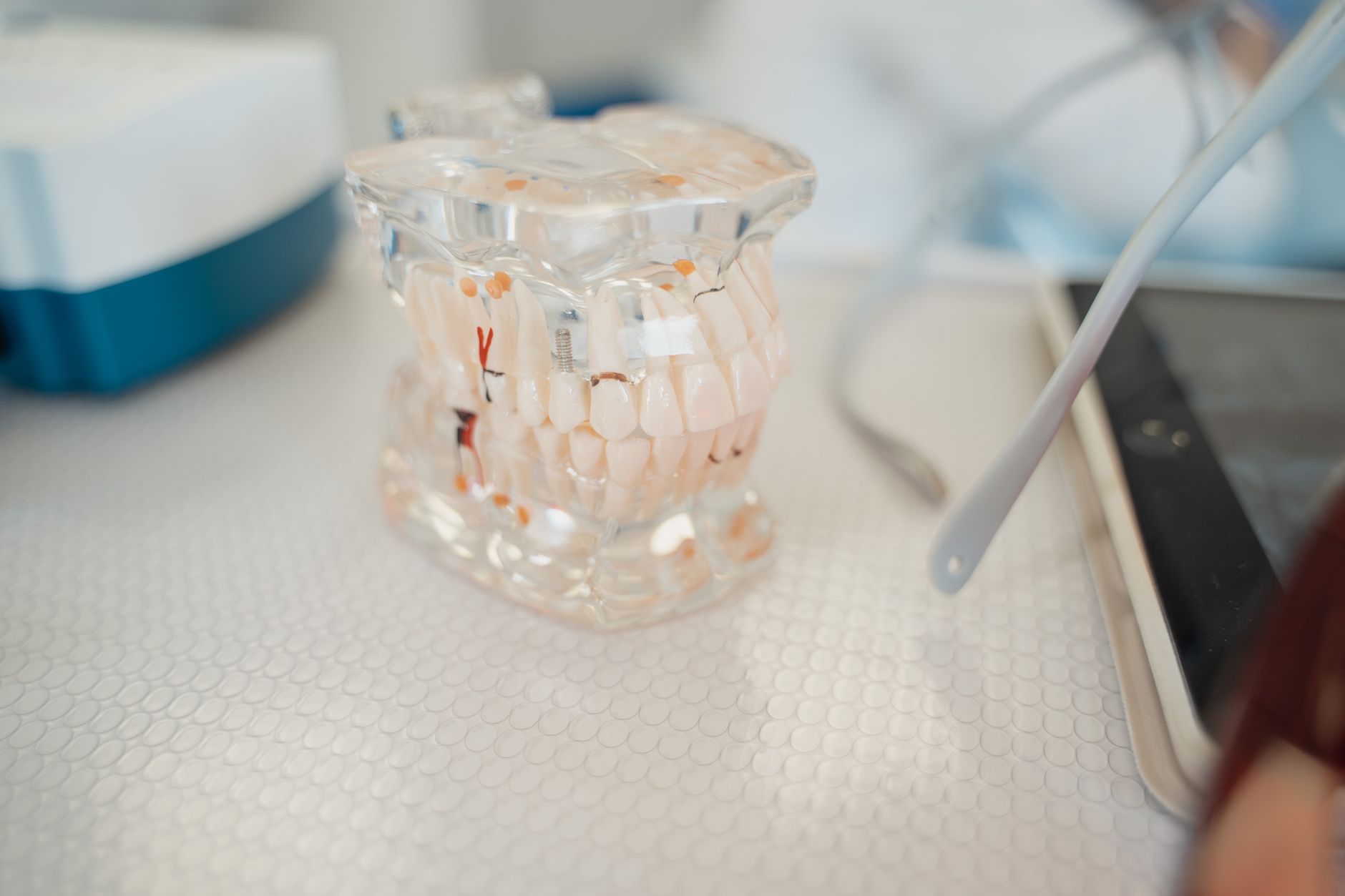 Patient receiving post-operative dental implant care and maintenance instructions from dentist