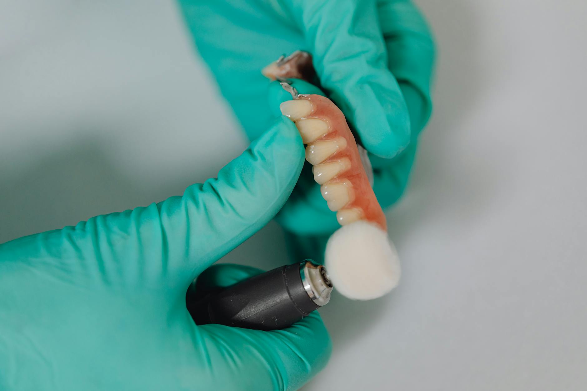 Close-up of dental implant procedure showing titanium post and tooth restoration in modern dental clinic