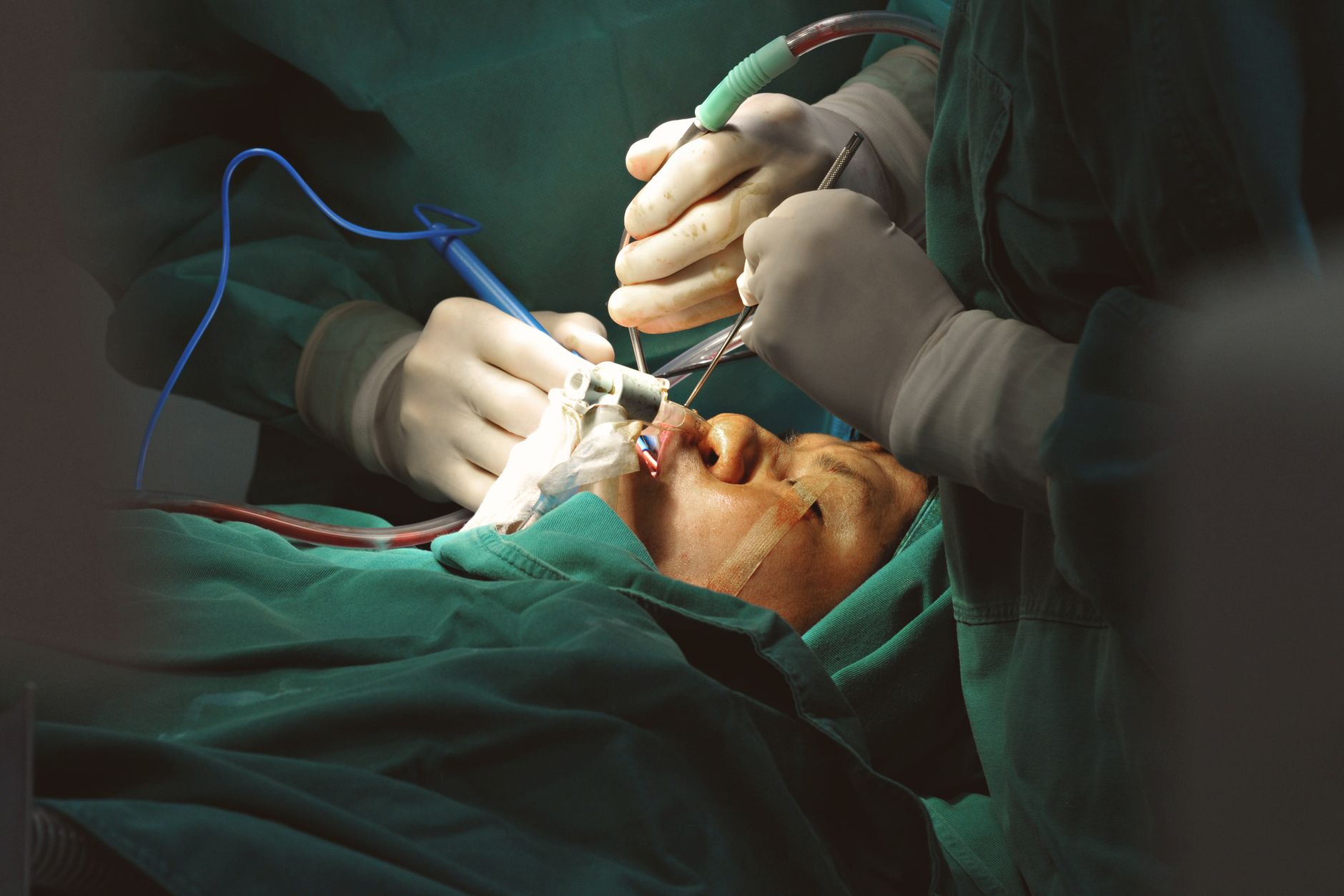 experienced plastic surgeon performing detailed nasal surgery in sterile operating room