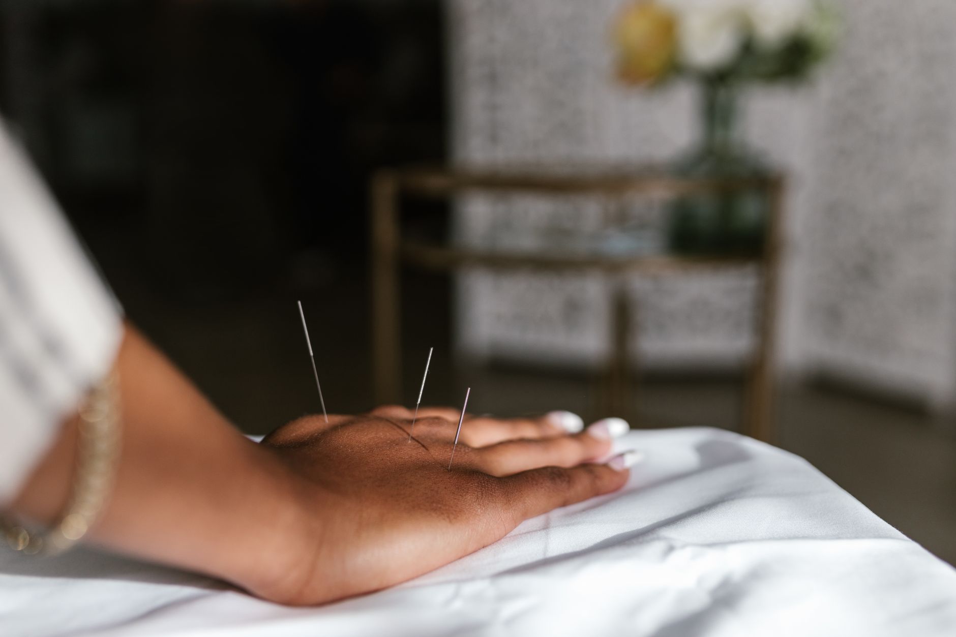 acupuncture therapist performing needle treatment on patient's back in medical clinic